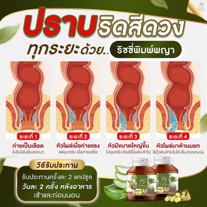 ซื้อ1แถม1-ริดสีดวง-ริดสีดวงทวาร-ติ่งโผล่-แก้ปัญหาริดสีดวงภายในและภายนอก-พิมพ์พญา-สมนไพรพิมพ์พญา-30เม็ด-1กระปุก-ส่งฟรี