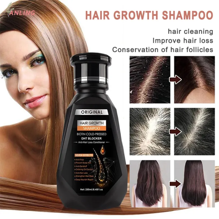 ✨Fast Delivery&COD✨hair growth shampoo anti-hair loss shampoo hair growth  essential oil hair