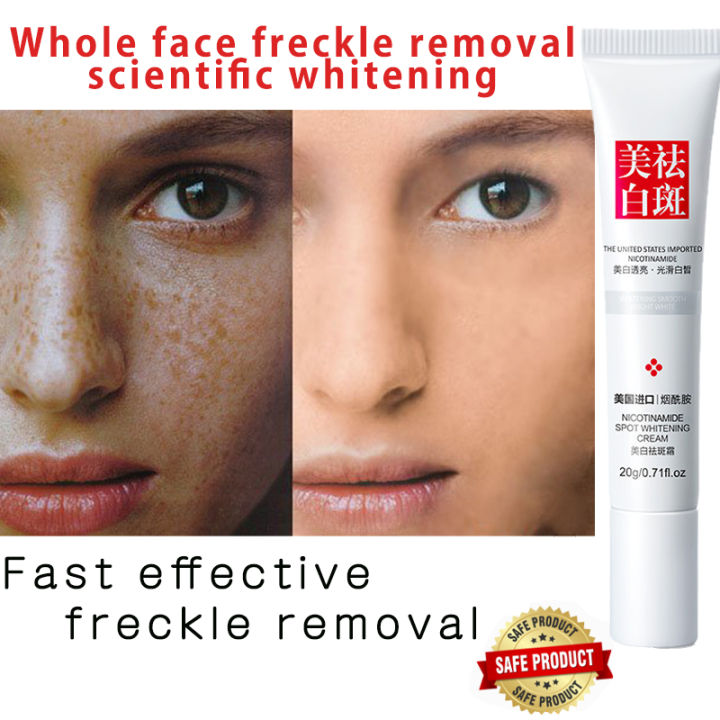 Fast Effective Freckle Removal Whitening Cream Genuine Removal Dark Spots Cream Remove Melasma