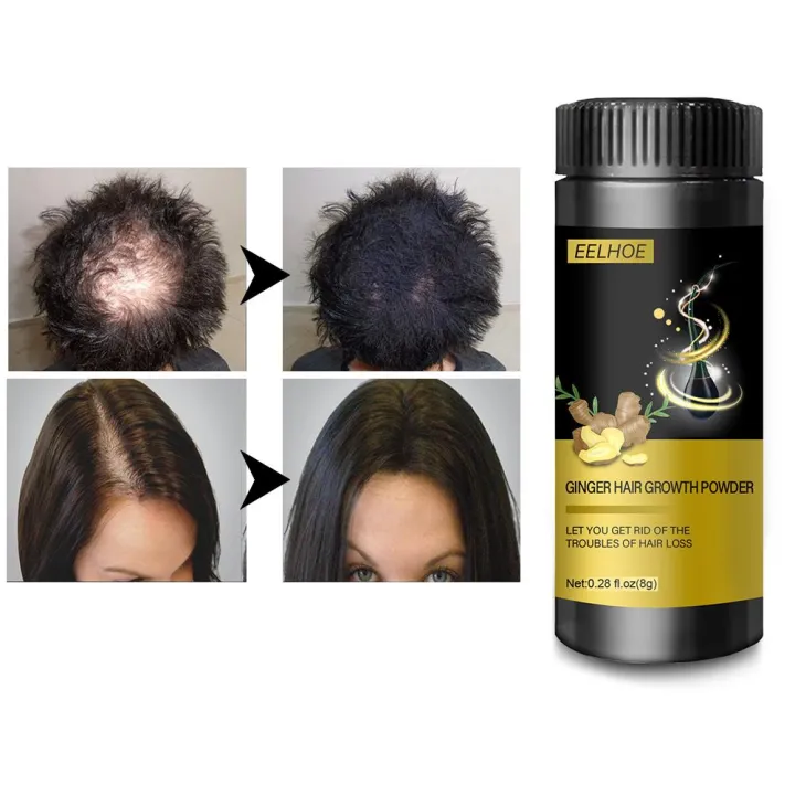 LOMG [Sale] Ginger Hair Powder ป้องกันผมร่วงและบำรุงหนังศีรษะ Natural Ginger Hair Growth Powder