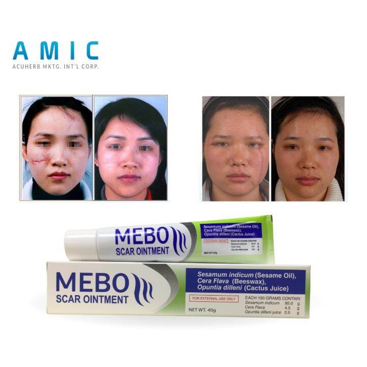 ☆MEBO Scar Ointment 40g For Acne Scar Remover Keloid Scar Remover ☆MEBO Scar Ointment 40g For Acne Scar Remover Keloid Scar Remover