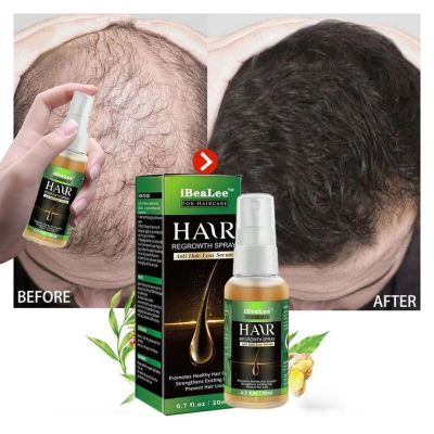 【cw】 Ginger Fast Growing Hair Essential Oil Hair Growth Product Beauty Hair Care Prevent Hair Loss Oily Scalp Treatment For Men Women ！