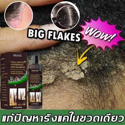 【พร้อมส่งจากไทยทันที】EELHOE แชมพูขจัดรังแค 100ML ขจัดรังแค หยุดอาการคัน ควบคุมน้ำมัน แชมพูสมุนไพร บำรุงเส้นผมและหนังศรีษะ(ยาสระผมเชื้อรา ยาสระผมรังแค ยาสระผมขจัดรังแค เชื้อราบนศีรษะ แชมพูแก้รังแค)