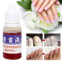 10ml Nail Repair Fungal Nail Treatment Onychomycosis Remove Nutritious Toe for Hand Foot Health Skin Care Nail Treatments TSLM1