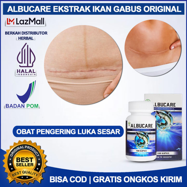 Albucare Kapsul Ekstrak Ikan Gabus Asli Obat Luka Sesar Pengering Luka Operasi Sesar Pasca 9561