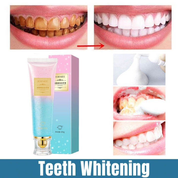 【Buy 2 Free 1】Teeth Whitening Toothpaste 100g Niacinamide Fresh Remove ...