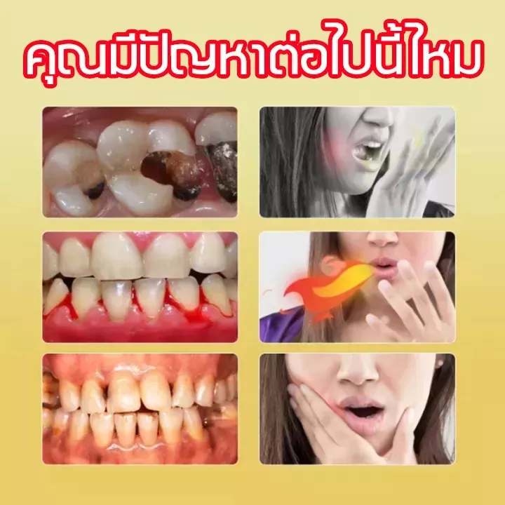 บอกลาอาการปวดฟัน-bee-venom-ยาสีฟัน110g-ดูแลสุขภาพช่องปากคุณ-ไม่ต้องเป็นห่วงเรื่องเหงือกบวม-ฟันผุและแผลในช่องปาก
