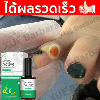 จัดส่งทันที ลอกหูดตาปลา ติ่งเนื้อ เห็นผลทันทีเมื่อใช่ต่อเนื่อง Corns warts prickles calluses flat removal liquid เซรั่มแต้มหูด ลอกหูดตาปลา