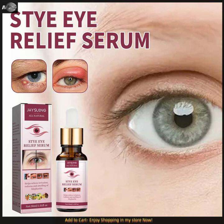 Treatment Eye Relief Serum for Styes Chalazion Blepharitis Gentle