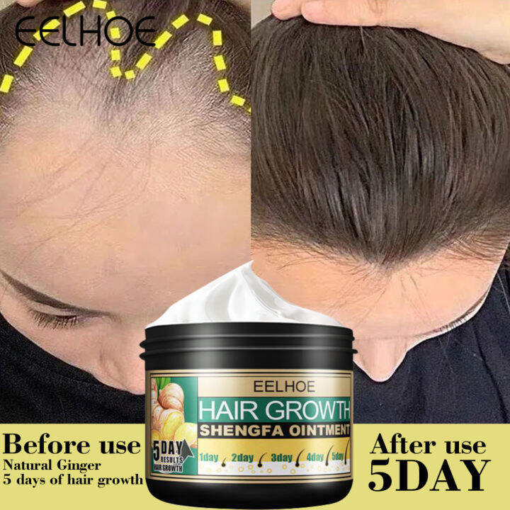 Eelhoe 5 Days Ginger Hair Growth Care Ointment Hair Fast Regrowth