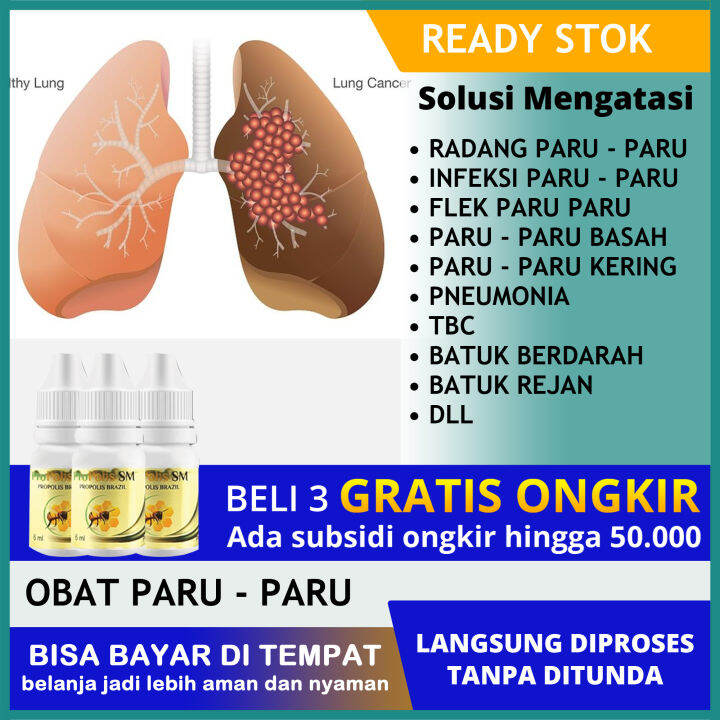 Obat Radang Paru Paru - Sakit Radang Tenggorokan, Tonsilitis, Paru Paru ...