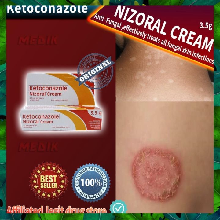 Nizoral Cream treats all fungal skin infections/ An-an Buni hadhad (3 ...