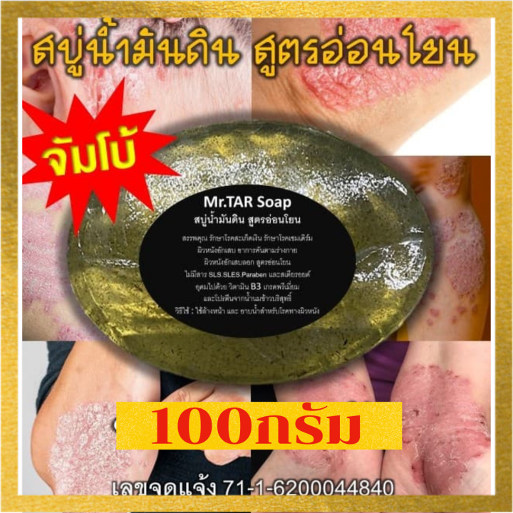 mr-tar-soap-สบู่น้ำมันดิน100กรัมแท้-สูตรอ่อนโยน-สบู่ผิวหนังอักเสบทุกประเภท-สะเก็ดเงิน-ชุดสุดคุ้ม-1-แถม-1-ส่งไว