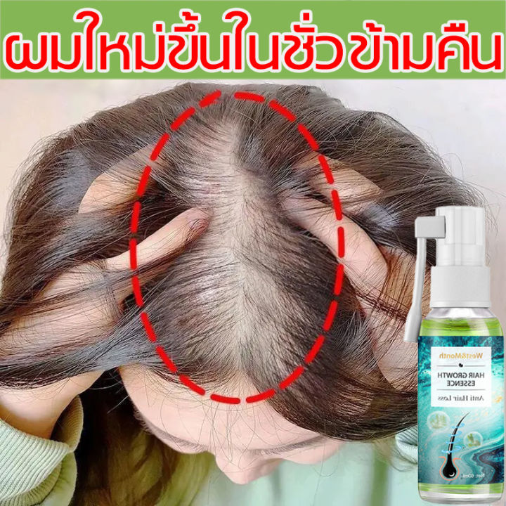 หมดปัญหาผมร่วง Eelhoe น้ำยาปลูกผม 30Ml เร่งการงอกใหม่ ป้องกันไม่ให้ขิงหลุด  รากผมแข็งแรง ดูแลหนังศีรษะ น้ำยาปลูกผมชาย เร่งผมขึ้นใหม่ สเปรย์ปลูกผม ยาปลูก ผมของแท้ เซรั่มบำรุงผม น้ำยาเร่งผมยาว ซรั่มปลูกผม ยาปลูกผมผู้ชาย เซรั่มปลูก ผม | Lazada.Co.Th