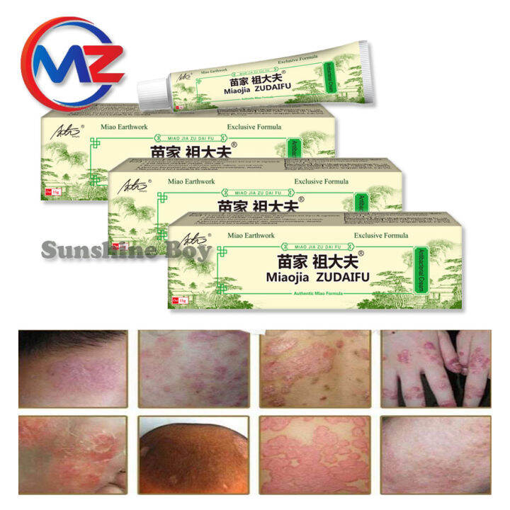 ( SET OF 3 ) Arturo 15g zudaifu Natural Chinese Herb Herbal Medicine