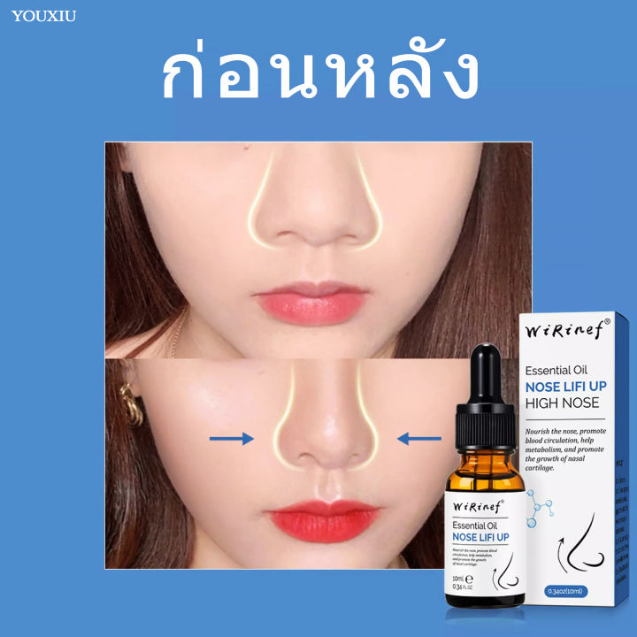 aichen-น้ำมันบำรุงจมูก-ปลอดภัยและมีสุขภาพดี-ปรับปรุงจมูกใหญ่-ทำให้จมูกสวยขึ้น-beauty-nose-oil-เปลี่ยนรูปทรงจมูก-เซรั่มจมูกสวย-เซรั่มทาจมูก