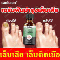 tanksenเซรั่มบำรุงเล็บ30ml ซ่อมเล็บที่ชำรุด น้ำยาซ่อมแซมเล็บ น้ำยาฟื้นฟูเล็บ ดูแลเล็บ เซรั่มฟื้นบำรุงเล็บ เซรั่มซ่อมแซมเล็บ เชื้อราเล็บมือ สำหรับเชื้อราที่เล็บ น้ำยาบำรุงเล็บ แก้เชื้อราเล็บ แก้ปัญหาเล็บเสีย ครีมบำรุงเล็บ น้ำมันบำรุงเล็บnail repair essence