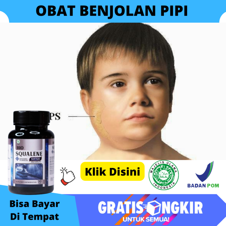 Obat Benjolan Di Pipi Bengkak, Benjolan Bernanah Di Atasa Bawah Pipi ...