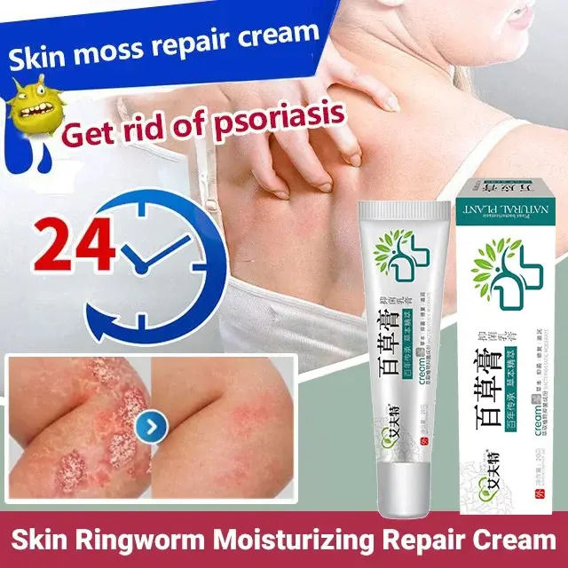 yidaoguang [1/2PCS]Psoriasis Eczema Antibacterial skin fungus cream ...