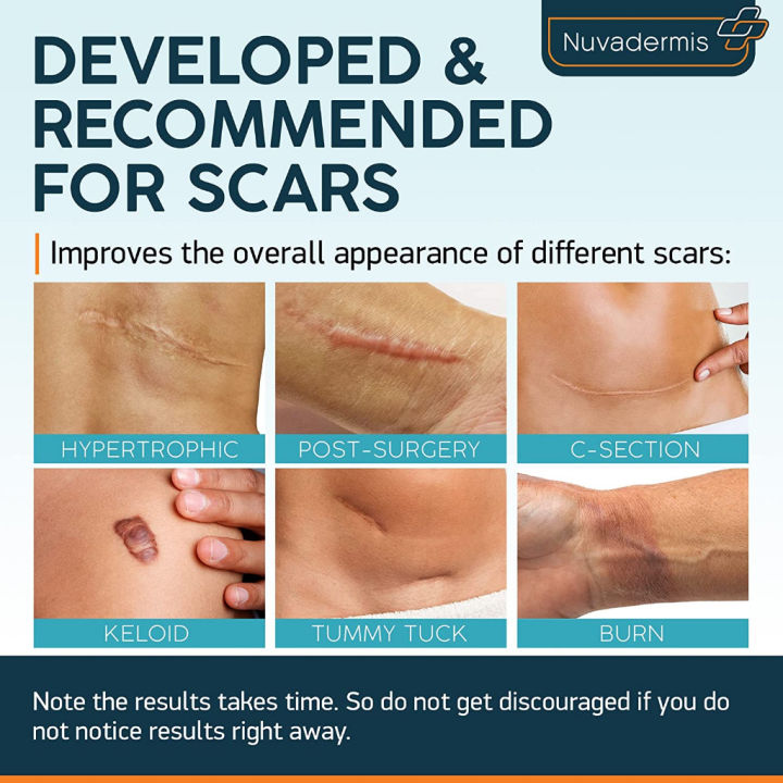 usa-nuvadermis-scar-removal-premium-medical-silicone-minimizes-all-types-of-scars-แผ่นแปะลดรอยแผลเป็น