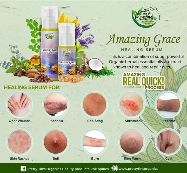 Wound Healing Herbal Serum Amazing Grace Serum for Skin Conditions