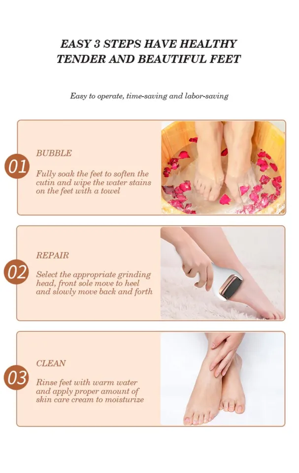 Share 174+ machine for cracked heels latest esthdonghoadian