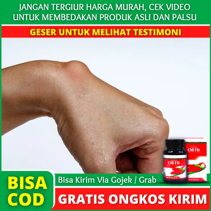 Obat Benjolan Di Tangan, Obat Benjolan Lipoma, Obat Benjolan Lemak ...