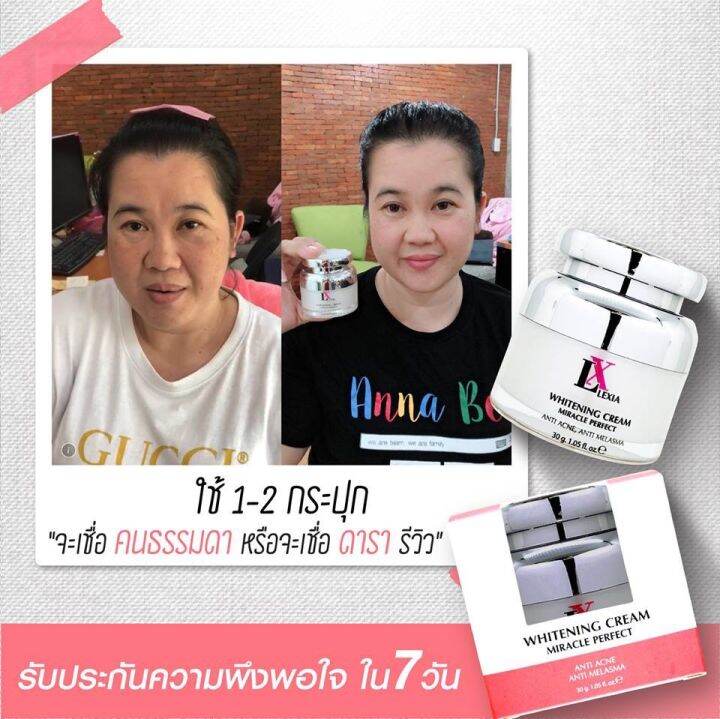 ครีมบำรุงผิวหน้า-lx-ไวเทนนิ่งครีม-1-กระปุก-ขนาด30กรัม-ราคา-750