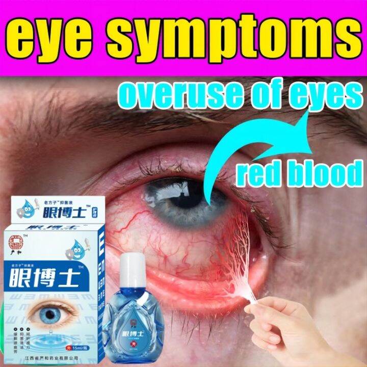 15ml cmd eye drops/japan eyedrop/japanese k9 hyssop eye drops/bioline ...