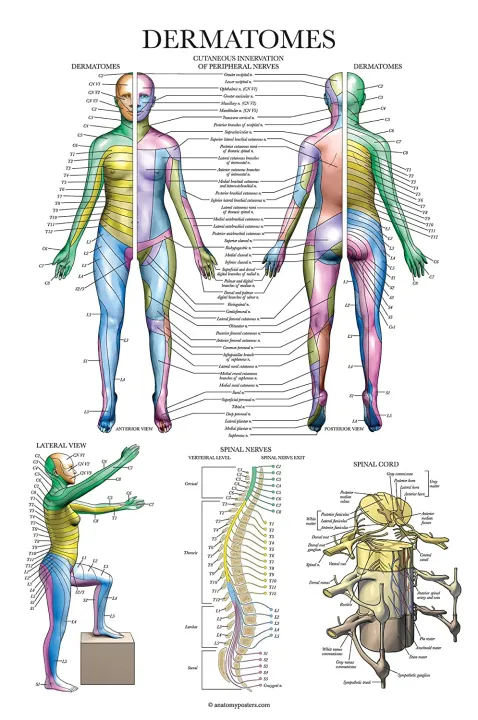 Dermatom Nervous System Anatomical Chart Dermatom Anatomy Poster Canvas ...