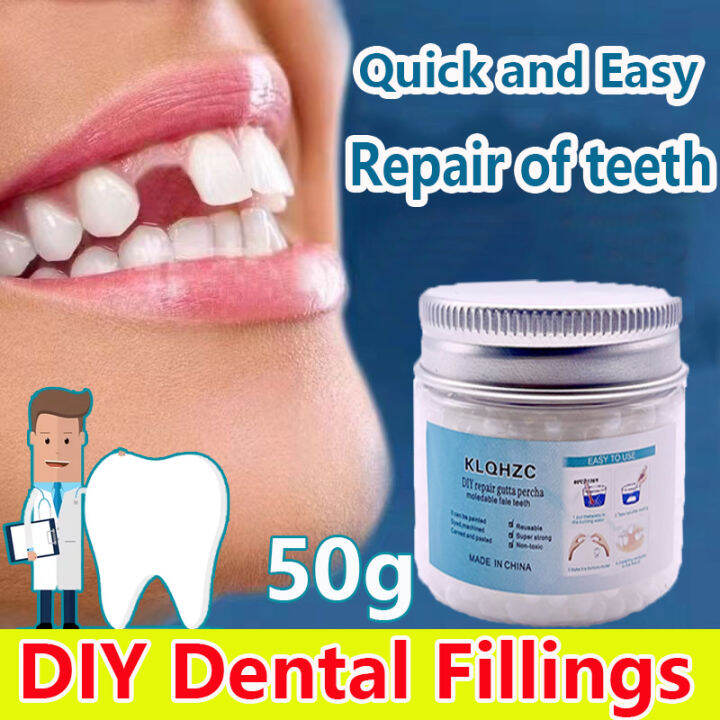 Fast Filling DIY Tooth Repair Kit 50g Temporary Tooth Repair kit ...