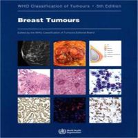 เต้านม Tumours: ผู้ที่จัดหมวดหมู่ของเนื้องอกเอกสารสีเต็ม