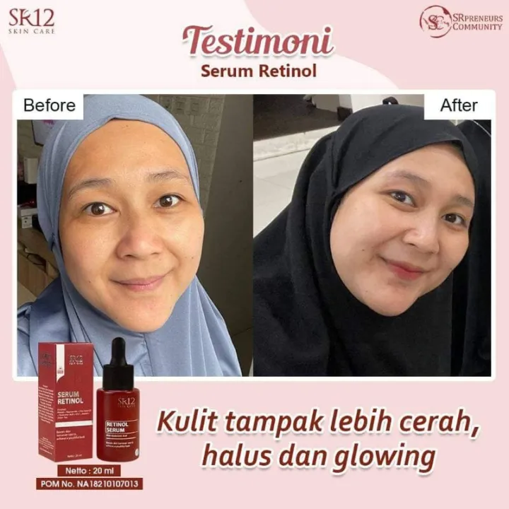 SR12 Retinol Serum 20ml - Serum Wajah Anti Aging Cegah Penuaan Dini ...