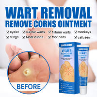 TataFairy【Ready Stock】 20G Foot Care Corn Removal Pads Warts Thorn Curative Cream Calluses Remove Callosity Wart Removal Ointment Against Moles