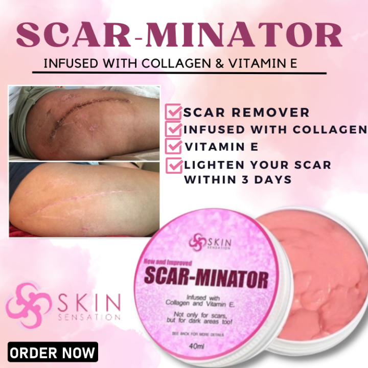 Original Scarminator Cream by Skin Sensation Best Scar Remover Acne