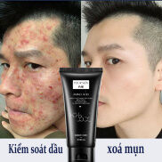 Sữa rửa mặt ngăn ngừa mụn axit amin xoá mụn hiệu quả cao và mụn đầu đen