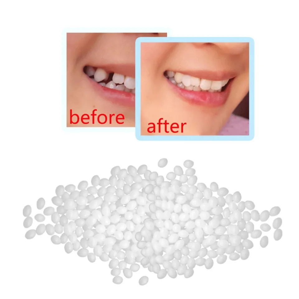 30ml Resin False Teeth Solid Glue Temporary Tooth Repair Set