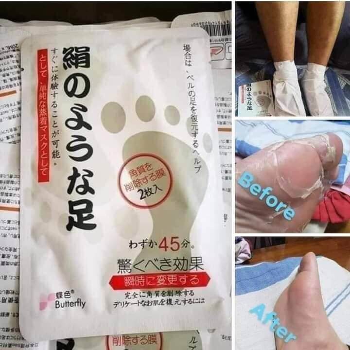 japan foot peeling mask Lazada PH