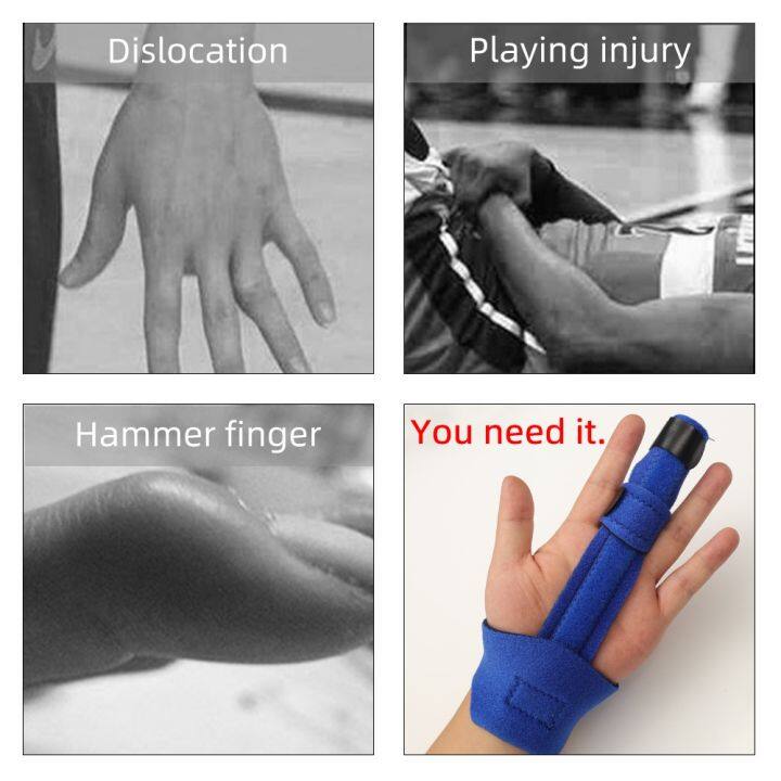 ปรึกษาอาการฟรี-trigger-finger-splint-เฝือกสวมนิ้วมือสามารถปรับได้