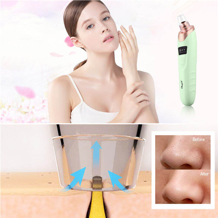 ckeyin-facial-blackhead-ance-remover-skin-ultrasonic-scrubber-face-lifting-deep-cleansing-exfoliator-nano-mist-sprayer-steamer