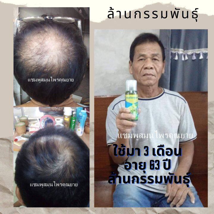 แชมพูลมผมร่วง-ผมมัน-ผมบาง-หัวไม่ล้าน-แชมพูสมุนไพรคุณยาย