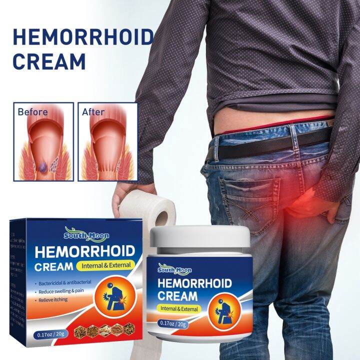 20g Hemorrhoids Cream Hemorrhoid Medicine Hemorrhoid Treatment Internal