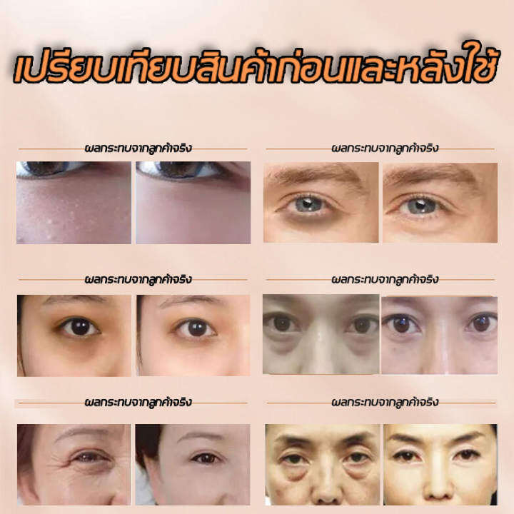 aichun-มาร์คใต้ตา-30ml-ครีมบำรุงใต้ตา-ครีมกำจัดตุ่มไขมัน-สมัครสัมผัสของความหมองคล้