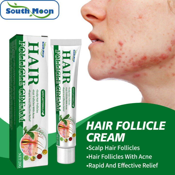 South Moon Hair Follicle Cream Treat Scalp Hair Folliculitis Skin