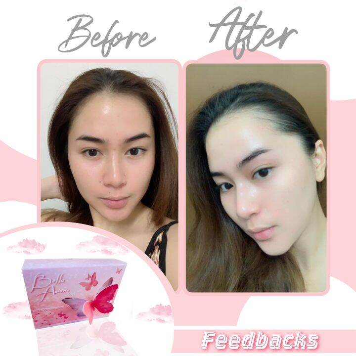 Bella Amore Premium Rejuvenating Set FDA APPROVED Lazada PH