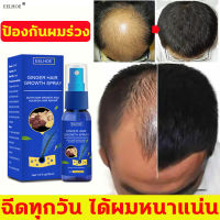 ELHOE 30ml havitaเซรั่มปลูกผม น้ำยาปลูกผม ดก สำหรับผมบาง ผมร่วง ป้องกันผมร่วง บำรุงรากผม hair serum Growth Essence Spray