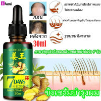 IFAMI ขิงเซรั่มบำรุงผม ป้องกันผมร่วง Hair Growth แก้ปัญหาหัวล้าน เร่งผมงอกใหม่ ปรับปรุงคุณภาพของเส้นผม น้ำยาปลูกผม เซรั่มผม เซรั่มปลูกผม 30ml