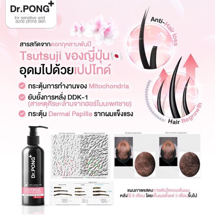 พร้อมส่ง-แชมพูลดผมร่วง-dr-pong-tsutsuji-gentle-shampoo-แชมพูลดผมร่วง-เพิ่มวอลุ่ม-anti-hairloss-shampoo