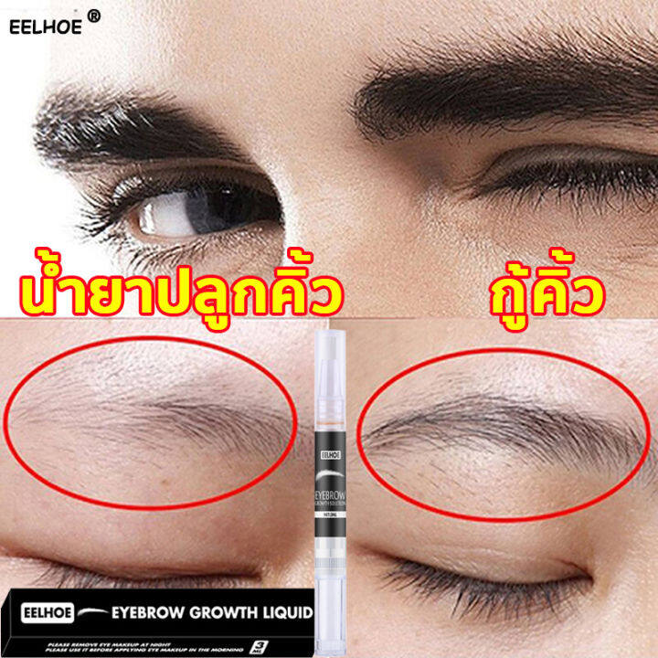 eelhoe-เซรั่มปลูกคิ้ว-น้ำยาปลูกคิ้ว-ทำให้หนาและเข้มขึ้น-บำรุงล้ำลึก-อ่อนโยนและไม่ระคายเคือง-เชรั่มปลูกคิ้ว-ปลูกคิ้ว-ยาปลูกขนคิ้ว-ที่ปลูกคิ้ว-การเติบโตของคิ้ว-เซรั่มคิ้วดกดำ-ยาปลูกคิ้ว-น้ำยาเร่งคิ้ว-ย้