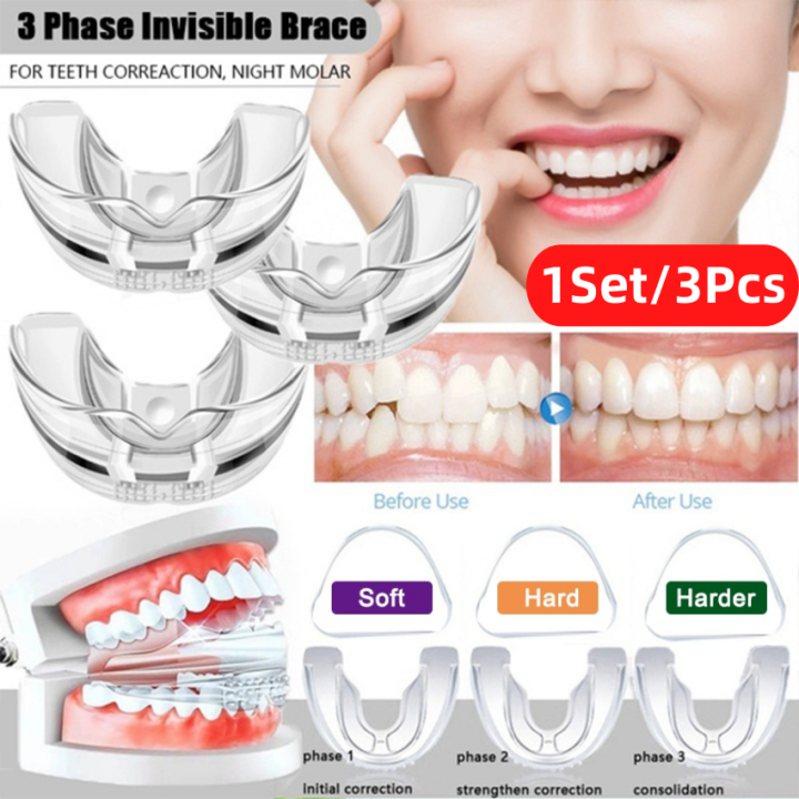 1Set 1-3Stage Orthodontic Braces Irregular Teeth Alignment Brace 4D ...